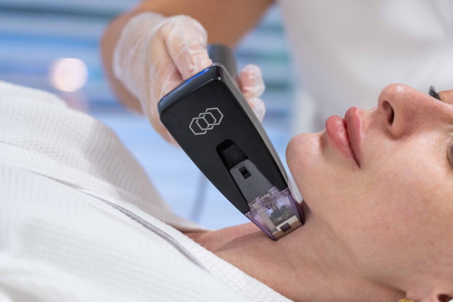 Acne scar removal treatment at Lucia Clinic