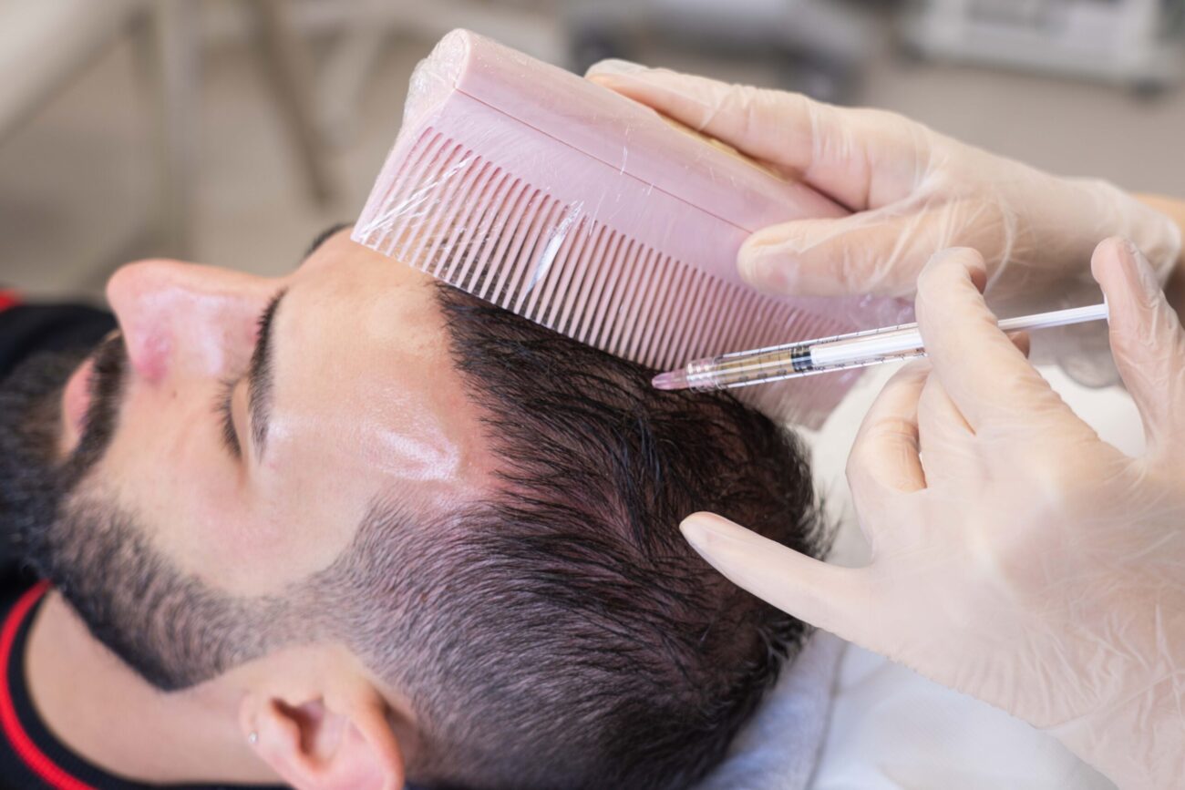 PRP treatment Dubai