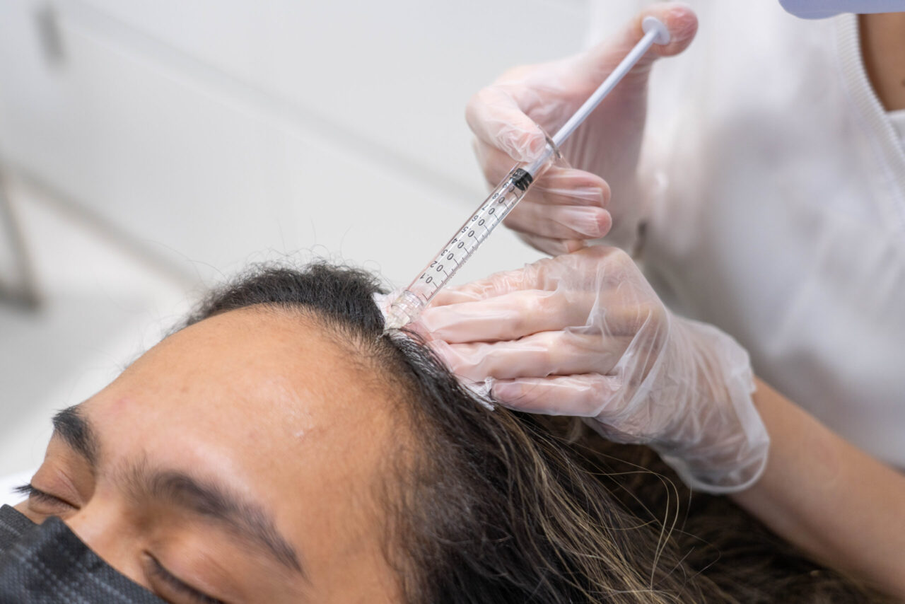 Acell + PRP treatment