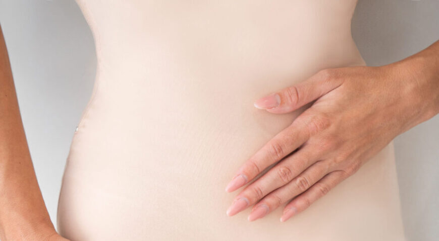 A woman after a liposuction