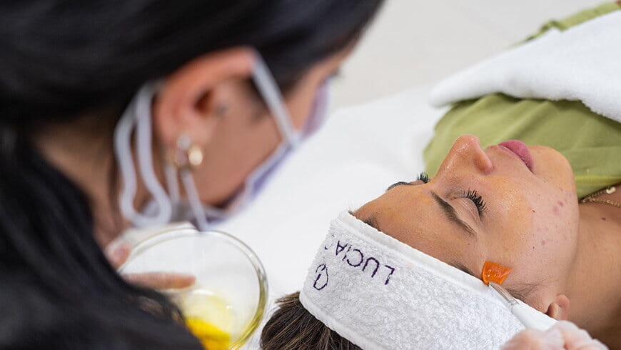 High-quality bespoke chemical peels at Lucia Clinic