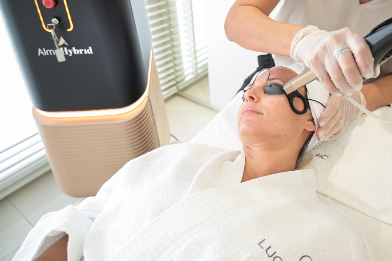 Fractional laser