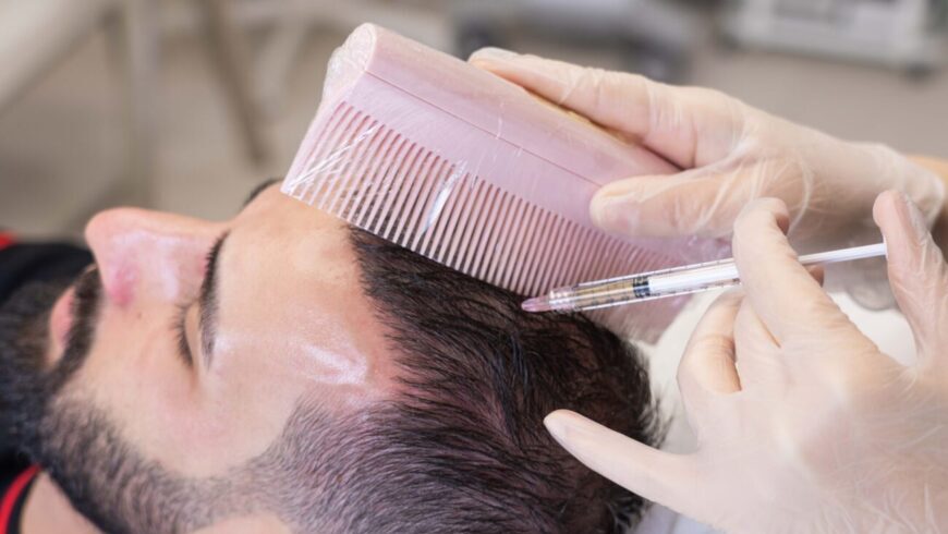 A man getting a treatment when the shedding first starts