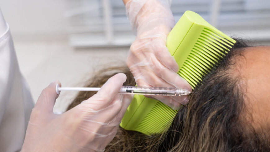 A person getting a therapy against hair loss