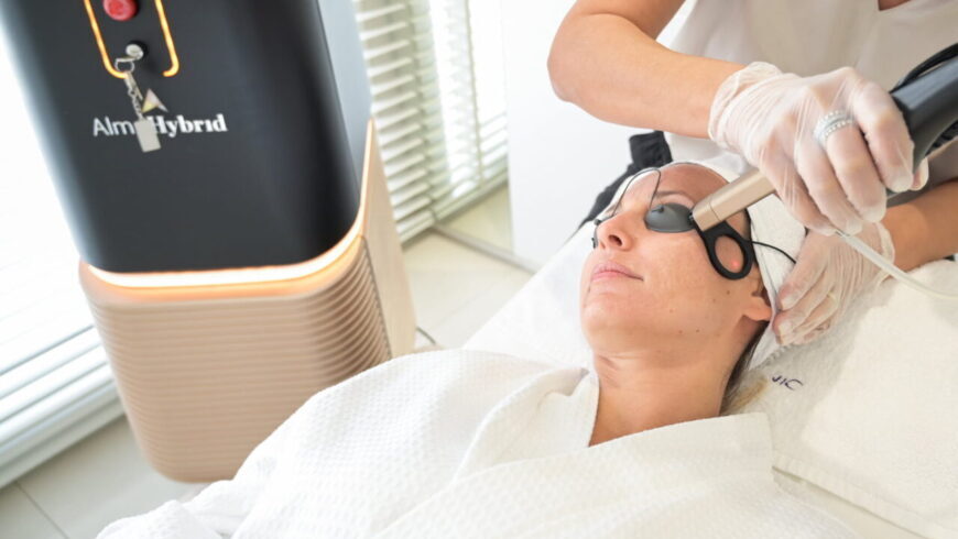 Fractional laser at Lucia Clinic