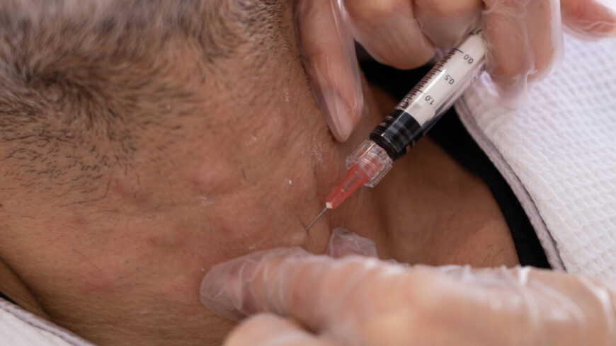 A man getting a treatment